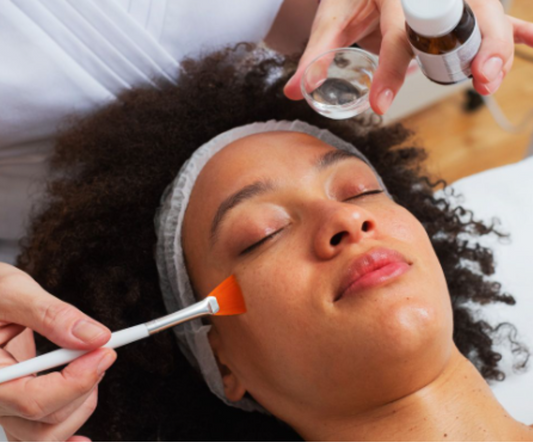 Unlocking Clear Skin: The Power of Chemical Peels for Blackhead Removal